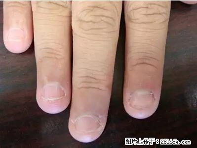 剪指甲、挖耳屎，这些日常小动作竟隐藏大危害！ - 迪庆生活资讯 - 迪庆28生活网 diqing.28life.net